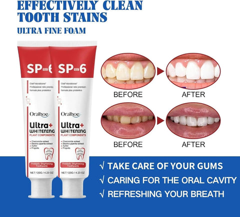 2 Pcs SP-6 Ultra Whitening Toothpaste