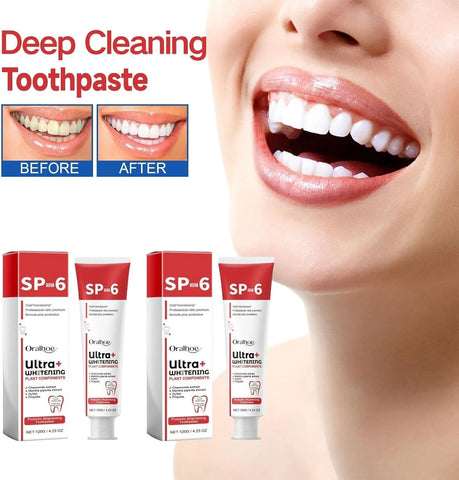 2 Pcs SP-6 Ultra Whitening Toothpaste
