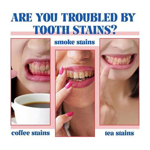 2 Pcs SP-6 Ultra Whitening Toothpaste
